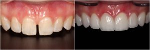 cosmetic dentistry