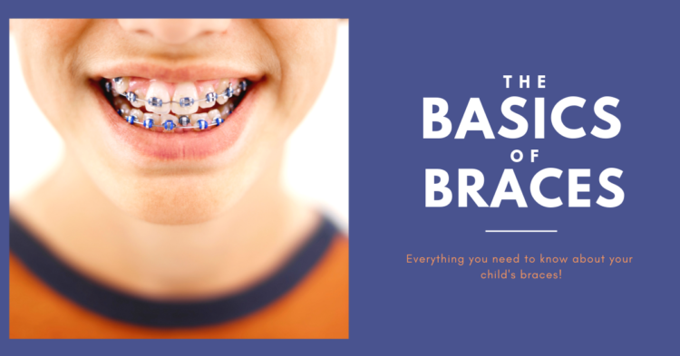 child needs braces
